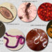Nigeria’s Hidden Burden Of Neglected Tropical Diseases