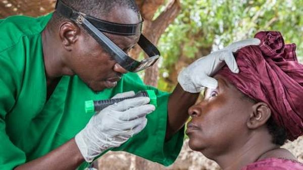 1.4m Nigerians Have Glaucoma – Eye Centre 1 Blind Nigerians