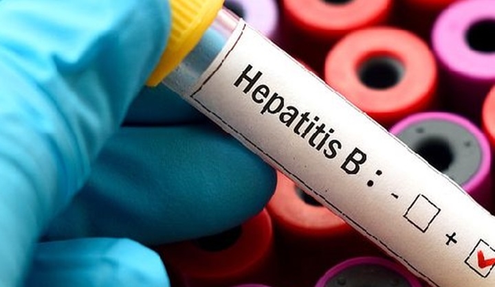 Enugu, Sepat Pharmaceuticals Begin Free Hepatitis Screening 1 Hepatitis B
