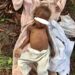 Aid Worker Rescues Abandoned Toddler From Akwa Ibom Bush, Seeks Donations For Treatment   