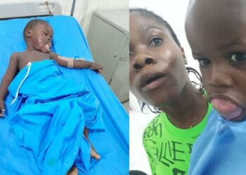 BSUTH Performs Successful Ranula Surgery On Toddler