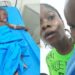 BSUTH Performs Successful Ranula Surgery On Toddler