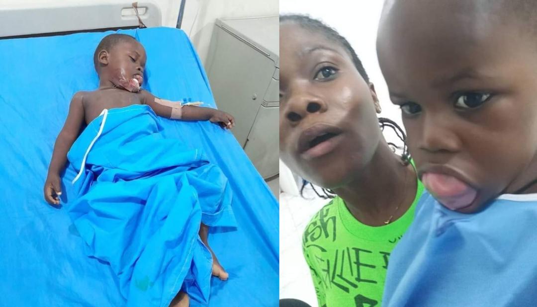 BSUTH Performs Successful Ranula Surgery On Toddler