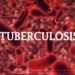 Benue Ranks Top In TB Burden In North Central – Commissioner 5 Benue Ranks Top In TB Burden In North Central – Commissioner
