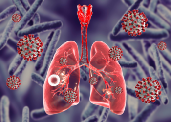 Time For Nigeria To Win Fight Against TB