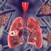 Time For Nigeria To Win Fight Against TB