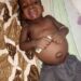 Family Seeks N3.7m For Leukaemia Chemotherapy For 2-yr-old Son 5 Family Seeks N3.7m For Leukaemia Chemotherapy For 2-yr-old Son