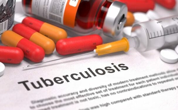 tuberculosis