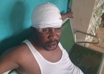 Ondo APC Primary: Violence Breaks Out In Akure South, Okitipupa LGAs