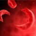 World Sickle Cell Day: Oyo Govt Offers Free Medication 5 Sickle Cell: Nigerian Surgeon Develops Therapy For Ulcers