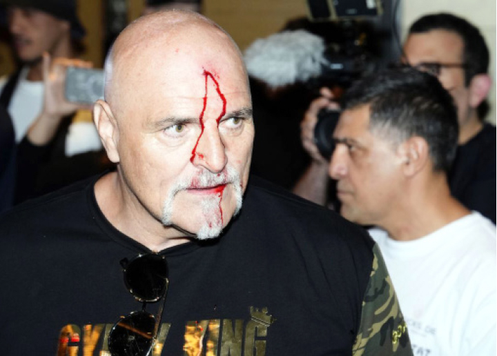 Tyson Fury's Father Head-butts Usyk Team Member 1 Tyson Fury Father