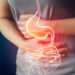 How Can I Solve Constipation? 4 How Can I Solve Constipation?