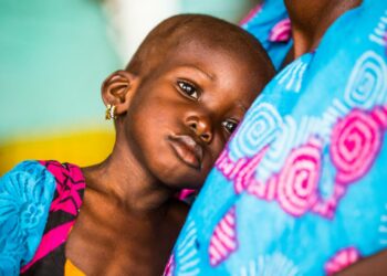 Malnutrition: Northern States Record Over 100% Surge  –  MSF