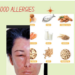 Allergies Are No Joke