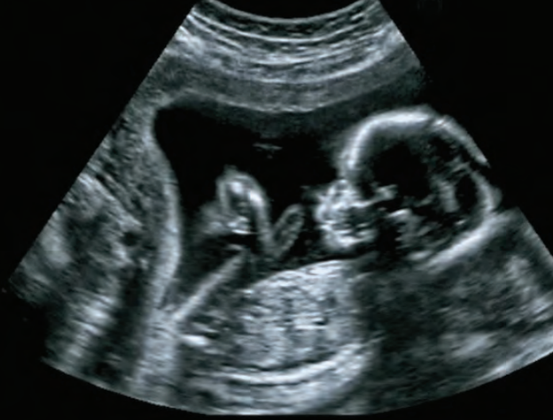 Why You Should Pray For Your Unborn Child 1 Screenshot 2024 06 30 101011