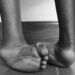 Experts Link Physical Disability To Untreated Clubfoot 5 Experts Link Physical Disability To Untreated Clubfoot