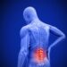 Exercises To Help With Back Pain