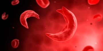Bridging The Sickle Cell Survival Gap In Nigeria 3 Nigeria’s Sickle Cell Crisis