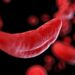 Nigeria’s Sickle Cell Crisis 5 ‘Sickle Cell Disease Not Death Sentence’