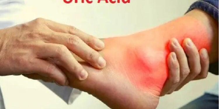 uric acid
