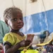National Financing C'ttee Tasks Federal Gov't On Prioritising Nutrition In 2025 Budget 5 Malnutrition: Why Access To RUTF Is Crucial