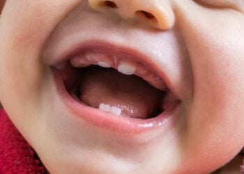 How To Soothe A Teething Baby: Tips, Remedies