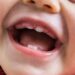 How To Soothe A Teething Baby: Tips, Remedies 5 How To Soothe A Teething Baby: Tips, Remedies
