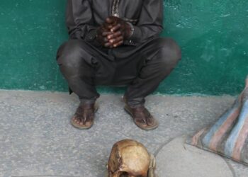 Police Arrest Man With Human Parts In Abuja
