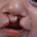Nigerians Cautioned Against Killing, Stigmatising Children With Cleft Lip, Palate 5 Woman Administers Oath On Victims Before Trafficking To India