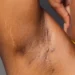 How To Use Baking Soda And Lime To Brighten The Armpits