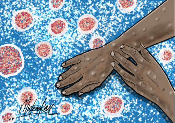 WHO Declares Mpox Global Emergency, What Next? 1 who