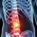 Spinal Cord Injuries: Group Calls For Inclusive development, Creation Of Trust Fund 5 Spinal Cord Injuries: Group Calls For Inclusive development, Creation Of Trust Fund
