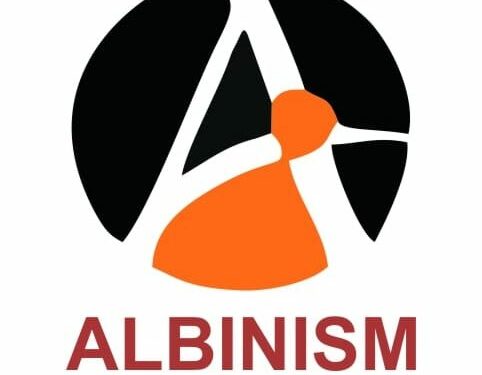 albinism