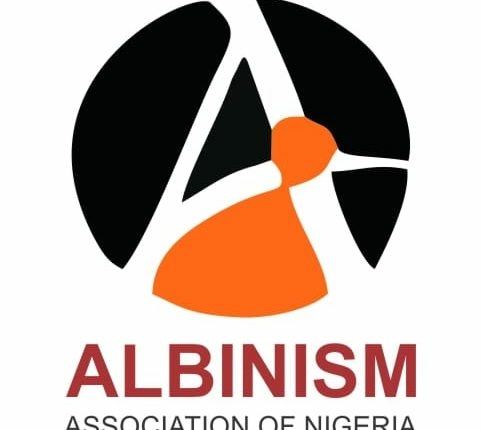 Group Intensifies Awareness On Albinism, Seeks FG, States’ Support 1 Albinism Association of Nigeria AAN