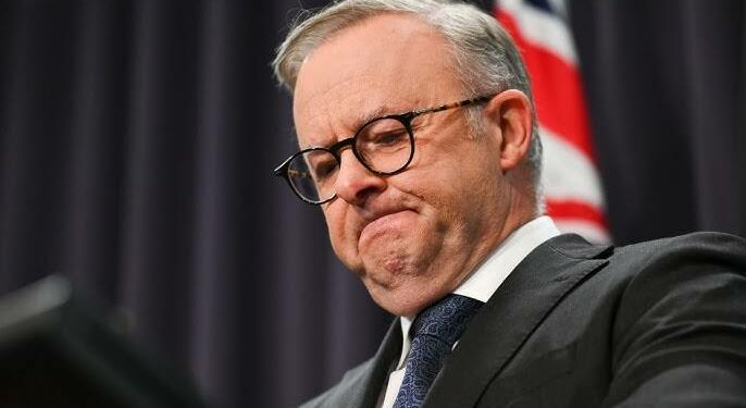 Anthony Albanese