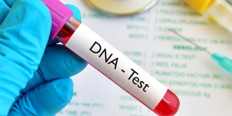 DNA test