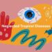 Nigeria’s Hidden Burden Of Neglected Tropical Diseases 5 Nigeria’s Hidden Burden Of Neglected Tropical Diseases