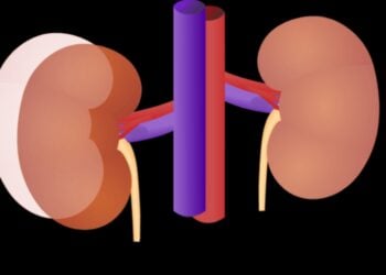 33.3% Nigerians, Ghanaians Risk Developing Kidney Disease — Study