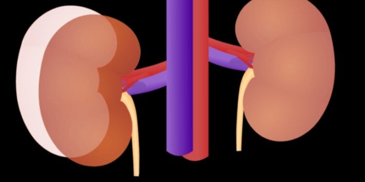 kidney disease