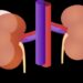 33.3% Nigerians, Ghanaians Risk Developing Kidney Disease — Study