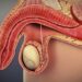 Pharmaceutical Firm Breaks New Ground With Innovative Prostate Treatment