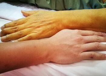 Early Pancreatic Cancer Symptoms You Must Not Ignore