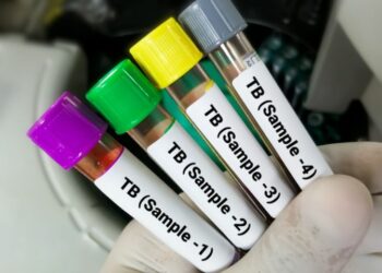 WHO Okays First-ever Prequalified TB Diagnostic Test
