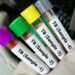 WHO Okays First-ever Prequalified TB Diagnostic Test