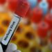 Tanzania Denies New Outbreak Of Marburg After WHO’s Alert 5 Marburg