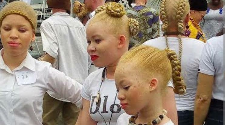 Skin Cancer: Bayelsa Albino Community Seeks Urgent Intervention 1 IMG 2430