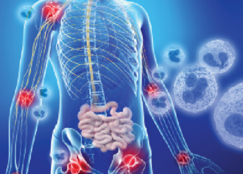 How Do I Handle Constipation?