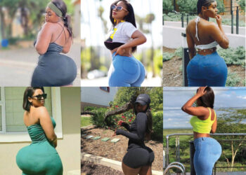 Booty Business: The Rising Trend Of Butt, Hip Enhancements Among Women