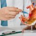 Surprising Facts About Ulcers You Might Not Know 5 Surprising Facts About Ulcers You Might Not Know
