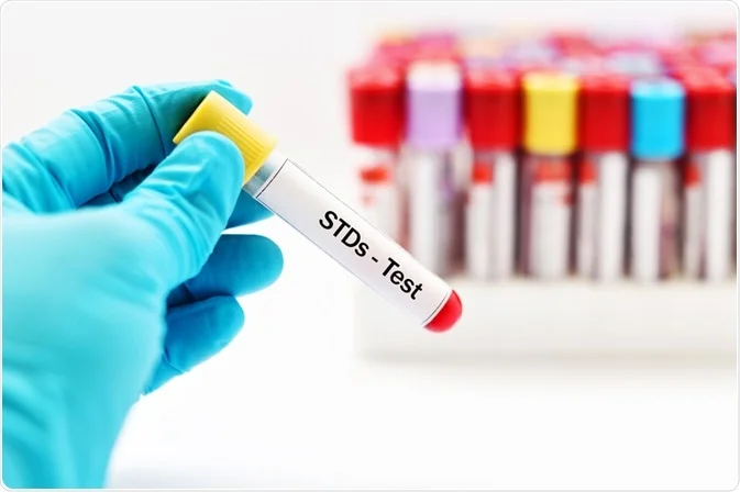 Things You Need To Know About Sexually Transmitted Diseases (STDs) 1 shutterstock 507985147
